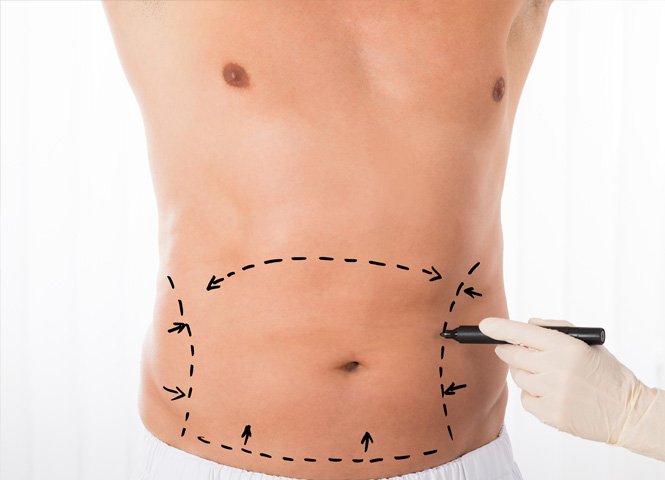 1763749247_body-procedure-1