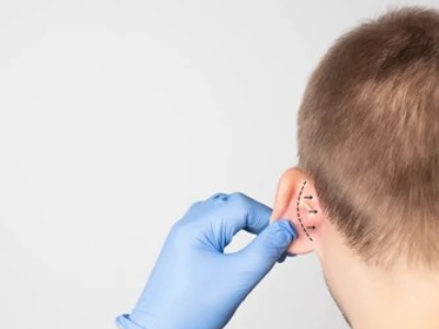 Surgical plan for ear pinning surgery on male child with protruding ears.
